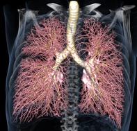 Lung3D_hiRes_BLACK_Bronchi_Vessels